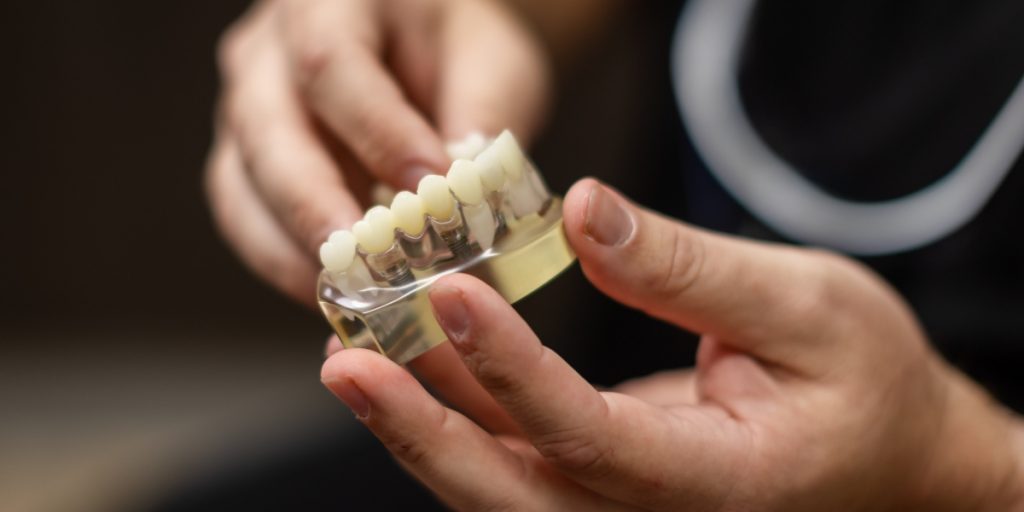 Procedures ceramic dental implants | Advanced Implant and Periodontal Specialists | Advanced Implant and Periodontal Specialists