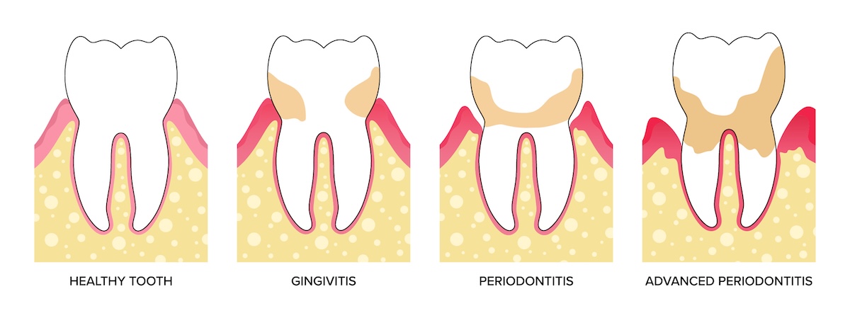  | Advanced Implant and Periodontal Specialists
